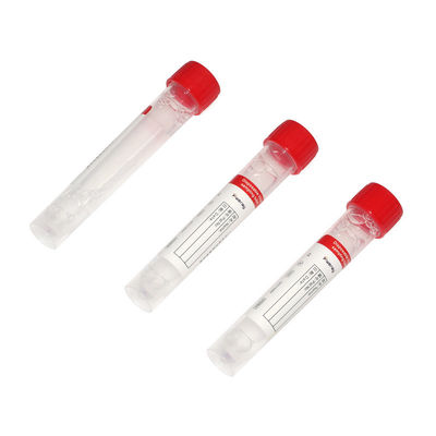 คุณภาพ  OEM ODM Service PCR Rapid Test Kit Nucleic Acid Release Reagent โรงงาน