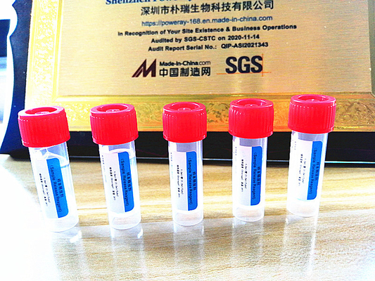 SGS Approval PCR Test Home Kit การสกัด DNA และ RNA สำหรับ Covid-19