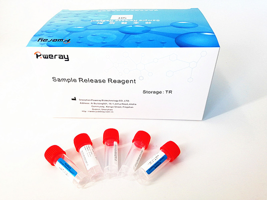 ตัวอย่างจมูก PCR การตรวจจับไวรัส RNA Mini Kit พร้อม ISO 13485